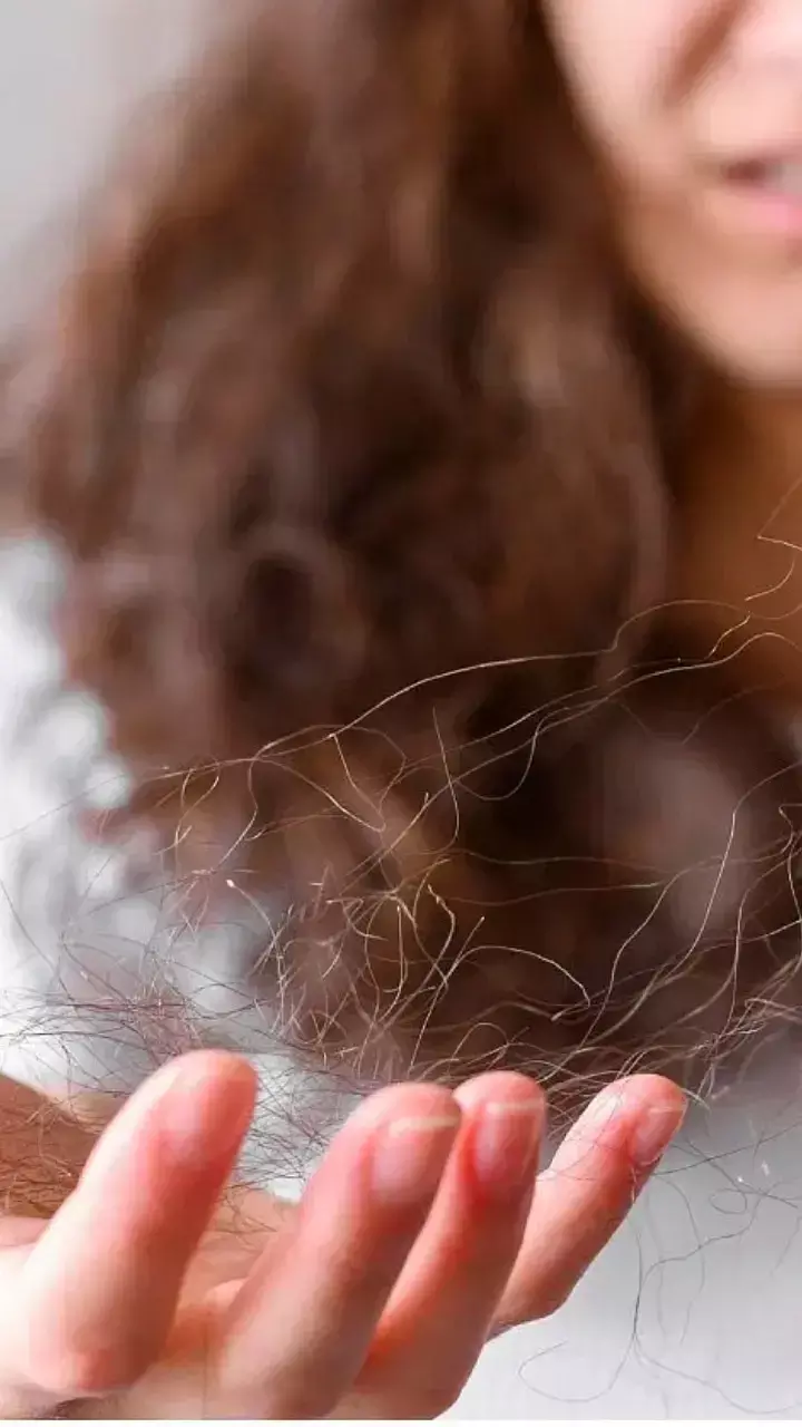 Balon ke Liye Kon Se Fal Khaye: बालों के झड़ने से हो परेशान! इन फलों को अपनी डाइट में करें शामिल, दिखेगा जबरदस्त असर...