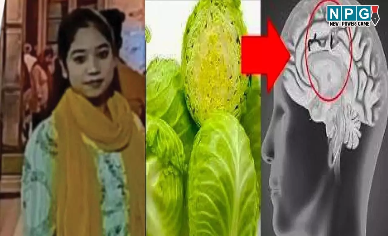 फास्ट फूड ने ली जान, पत्ता गोभी का कीड़ा दिमाग में घुसा, छात्रा की हो गई मौत...