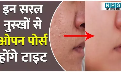 Home Remedies To Close Open Pores: पार्लर जाकर नहीं लगवानी पड़ेंगी चेहरे पर मेकअप की परतें, इन सरल नुस्खों से ओपन पोर्स होंगे टाइट...