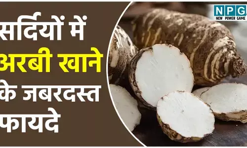 Arbi Khane Ke Fayde: अरबी  दिल-दिमाग को रखे स्वस्थ, सर्दियों में बनाए रखे ऊर्जा, इम्यूनिटी भी बढ़ाए, जानिये सर्दियों में अरबी खाने के  जबरदस्त फायदे