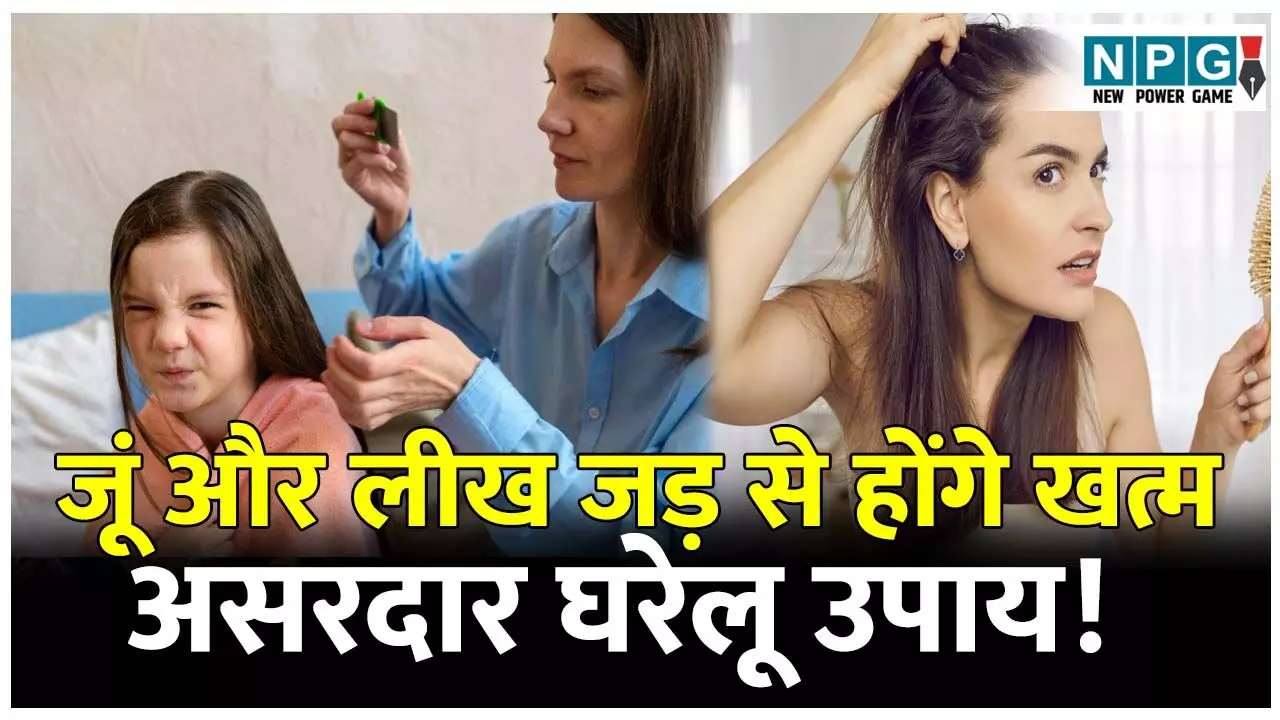 Sir ke juon ko kaise dur Karen: जूं की समस्या से है परेशान? जानिए सिर की जूं और लीख को जड़ से खत्म करने के 4 असरदार घरेलू उपाय! Sir ke juon ko kaise dur Karen: जूं की समस्या से है परेशान? जानिए सिर की जूं और लीख को जड़ से खत्म करने के 4 असरदार घरेलू उपाय!