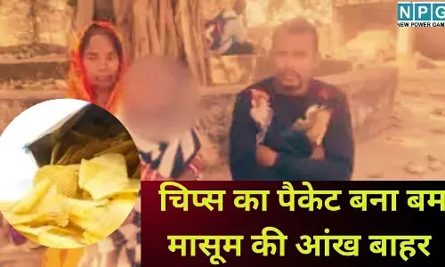 Chips Packet Blast Balangir : मासूम की जिंदगी में अंधेरा लाया चिप्स का पैकेट : आग के पास फटते ही बाहर निकली 8 साल के बच्चे की आंख, कंपनी पर FIR, पढ़े पूरी खबर