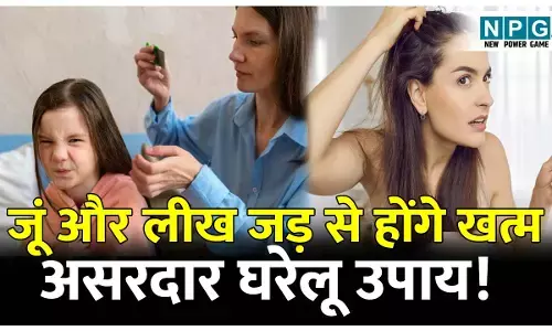 Sir ke juon ko kaise dur Karen: जूं की समस्या से है परेशान? जानिए सिर की जूं और लीख को जड़ से खत्म करने के 4 असरदार घरेलू उपाय!
