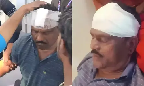 MP Crime News: भाजपा विधायक कालूसिंह पर हमला, सिर पर किया पत्थर से किया वार, लहूलुहान हालत में पहुंचे अस्पताल