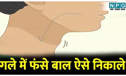 Gale mein fase Baal ko kaise nikale: गले में बाल फंस जाए तो क्या करें? जानिए इसे निकालने के 3 आसान और घरेलू उपाय!