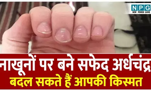 Nakhunon Par Bne Safed Dhabbey Ka Rahasya: नाखूनों पर बने ये सफेद अर्धचंद्र निशान बदल सकते हैं आपकी किस्मत, जानिए क्या कहते हैं ये सफेद धब्बे!