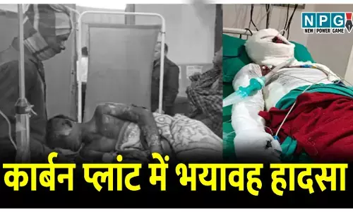 CG News Plant Accident: CG कार्बन प्लांट हादसा: 90% झूलसे तीन मजदूर वेंटिलेटर पर, मासूम की मौत, एक ही परिवार के चार सदस्यों की हालत नाजूक