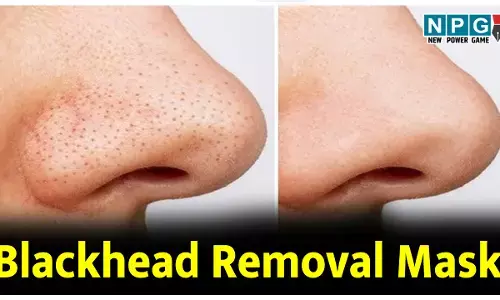 Blackhead Removal Mask: बिना पार्लर जाए, इस ब्लैक हेड रिमूवल मास्क से हटाएं ब्लैक हैड्स, निखरा चेहरा लगेगा खूबसूरत