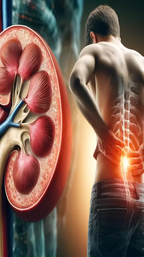Kidney को डैमेज करता है ये Painkiller? हो जाएं सतर्क वरना...