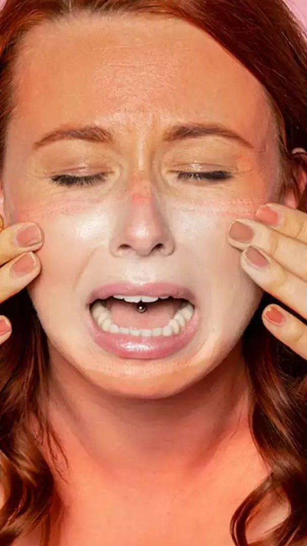 तेज धूप से जलने लगी है त्वचा? तुरंत राहत के लिए जानें ये 5 आसान तरीका