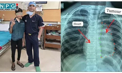 CG News: 11 साल के बच्चे के दिल से चिपका दुर्लभ कैंसर निकाला, बना विश्व कीर्तिमान, स्टेज-3 इनवेसिव थायमिक कैंसर का सफल ऑपरेशन