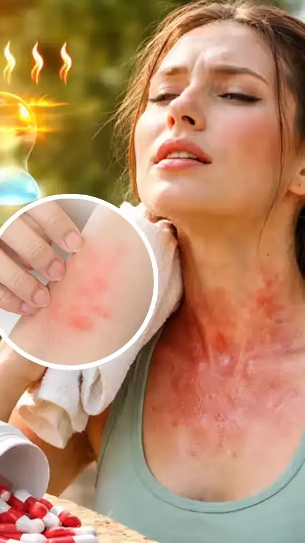 कैसे पाएं गर्मियों में पसीने से होने वाली एलर्जी से छुटकारा, अपनाएं ये आसान तरीका