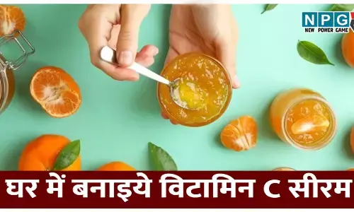 Homemade Vitamin C Serum And Toner: घर में बनाइये विटामिन सी सीरम और टोनर, स्किन एजिंग डिले होगी, चमकेगा चेहरा