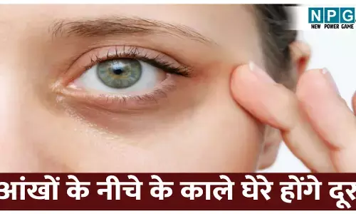 Dark Circles Home Remedies: आंखों के नीचे के काले घेरे दूर करेंगी ये आसान होम रेमेडीज़