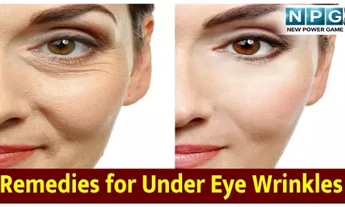 Home Remedies for Under Eye Wrinkles: ​आंखों के नीचे की झुर्रियां और Crows Feet से छुटकारा पाने के आसान घरेलू उपाय
