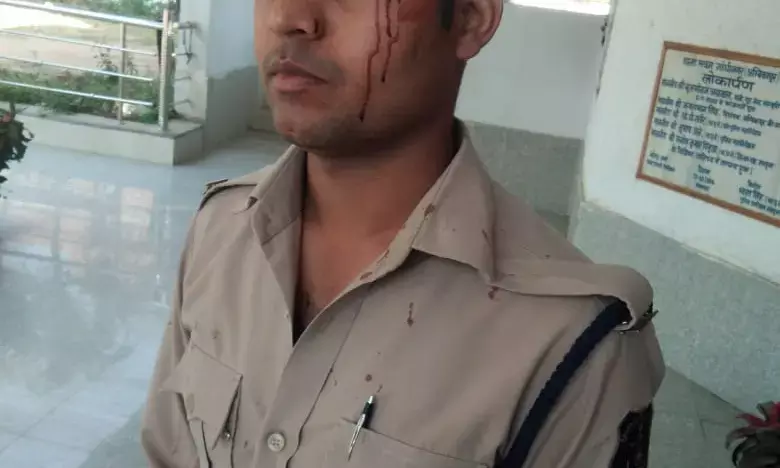 कुत्ते को बांधने वाले चेन से सिपाही को घर से निकाल कर पीटा..कुत्ते को घर के सामने शौच कराने से मना किया था सिपाही ने..