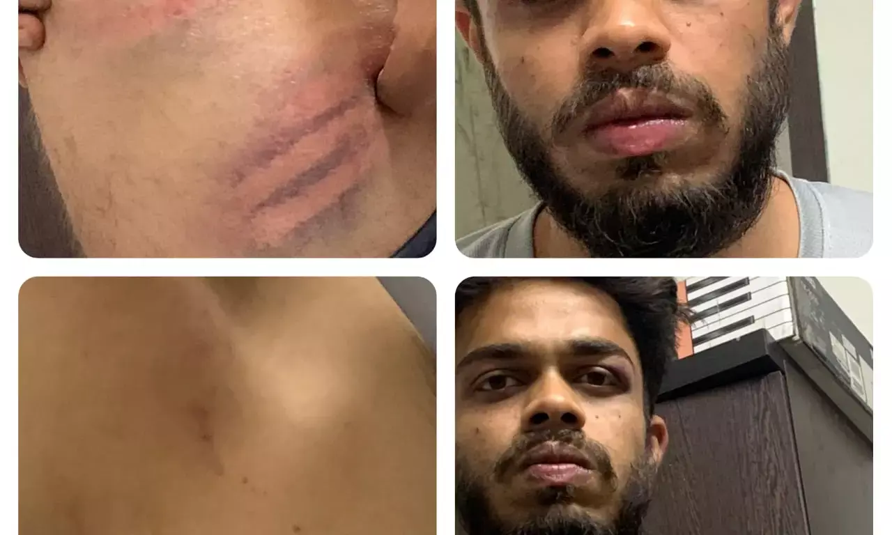 दुकानदार को पीटने से पुलिसवालों को रोका तो युवक की TI ने करवा दी बेदम पिटाई….पिता ने सोशल मीडिया में पोस्ट की आपबीती….”थाने लाकर जबरन पिलाई शराब, पॉकेट में रख दिया गांजे का पॉकेट”