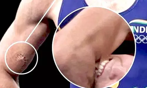 हारने लगा तो भारतीय पहलवान को दांत काट लिया : दांत काटने पर भी रवि दहिया ने नहीं छोड़ी गर्दन, कजाखिस्तानी पहलवान की करतूत पर भड़के लोग