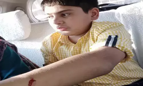 कुत्ते की वजह से करोड़पति भिड़े : रायपुर में दोनों परिवारों ने एक-दूसरे के खिलाफ कराया मामला दर्ज….. कुत्ते से शुरू हुआ विवाद मारपीट और फिर थाने तक पहुंचा