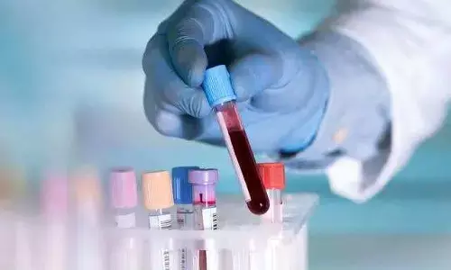 ASI के मौत की होगी जांच : कोरोना वैक्सीन लगने के 48 घंटे बाद हुई थी एएसआई की मौत….. पोस्टमार्टम रिपोर्ट के बाद अब AEFI  करेगी कारणों की जांच…