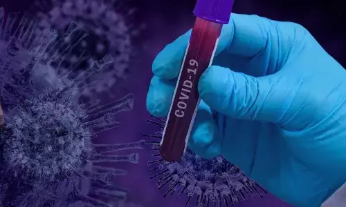 बीवी से पीछा छुड़ाने इस व्यक्ति ने बनाई फर्जी कोरोना पॉजिटिव रिपोर्ट, फिर ऐसा हुआ कि पुलिस में मामला पहुंच गया