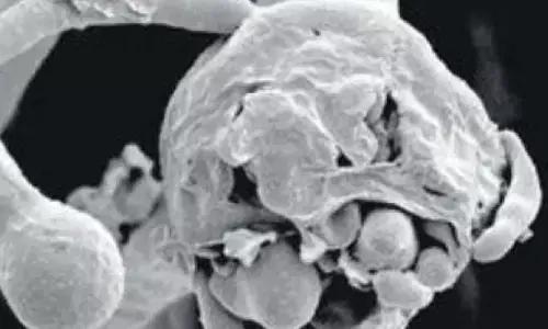 ब्लैक फंगस के बाद अब व्हाइट फंगस ने ढ़ाना शुरू किया कहर…. स्वास्थ्य विभाग अलर्ट पर….ब्लैक फंगस और कोरोना से भी है खतरनाक..जानिये क्या कहते हैं एक्सपर्ट